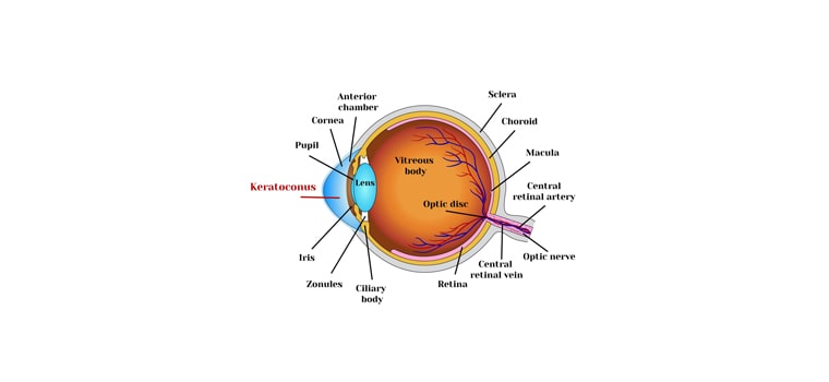 علاج انفصال شبکية العين