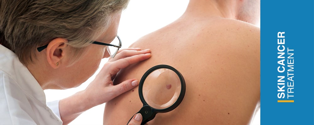 What is skin cancer?