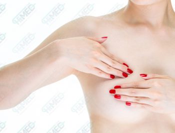 Lumpectomy (Breast-Conserving Surgery)