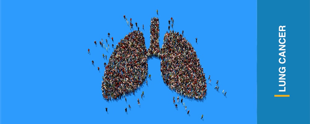 Different Lung Cancer Treatments