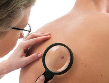 هر‌آنچه لازم است درباره سرطان پوست بدانید