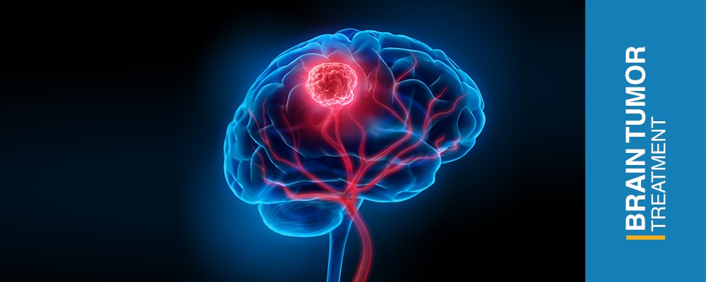 تومور مغزی ؛ علائم و روش‌های درمان آن