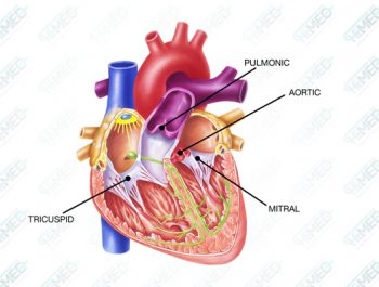 جراحی دریچه قلب